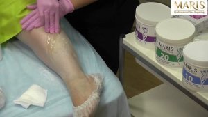 Шугаринг Марис. Залипы и как с ними бороться.