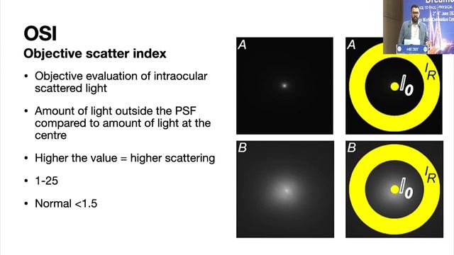 AIOC2022 - IC189 - Refractive surgery toolbox: What all do we need to become suc...Dr Sheetal Brar смотреть онлайн