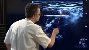 Axillary Brachial Plexus Block - Regional anesthesia Crash course with Dr. Hadzic