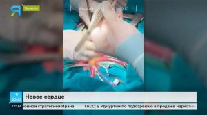 О трансплантации в ОКБ №1 подробности в сюжете Ямал-Медиа.mp4