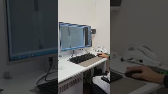 Гниды на волосах. С чем можно спутать