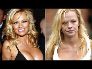 Знаменитости, Которые Сильно Себя Запустили