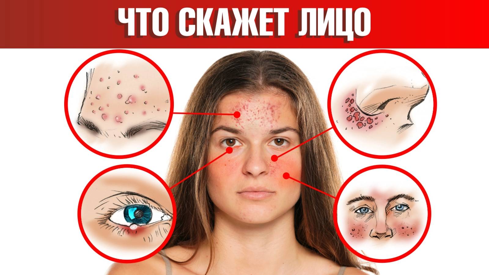 Болезни налицо. 18 признаков, которые расскажут о проблемах