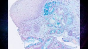 Alcian Blue Staining  - Slides