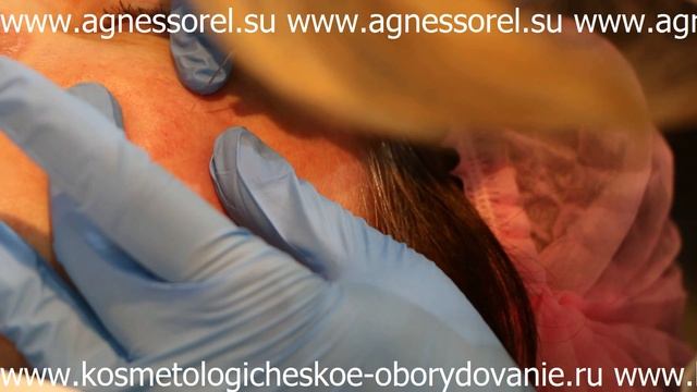 Косметологическое Оборудование Ру - Коагулятор косметологический смотреть онлайн