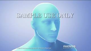 Гамма нож в лечении невралгии тройничного нерва. смотреть онлайн