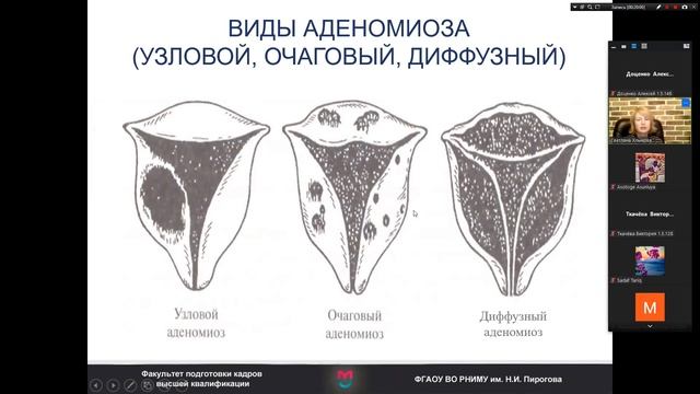 Эндометриоз. Гинекология. 5 курс. Хлынова С.А. Часть 1.