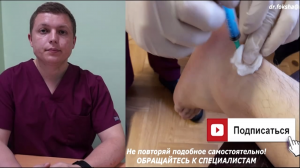 Техника блокады лодыжки Блокада икроножного нерва по Бауну Sural Nerve Block