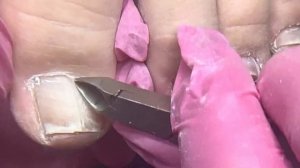 Невероятное преображение ???треш педикюр