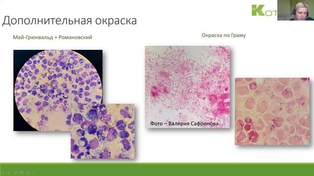 Цитологическое исследование выпотов  / ветеринарная клиника