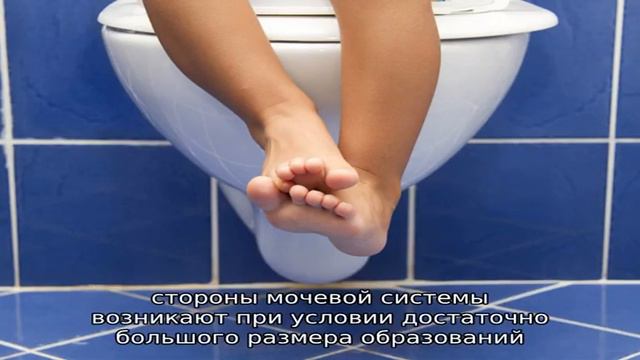 Причины обильного мочеиспускания у женщин