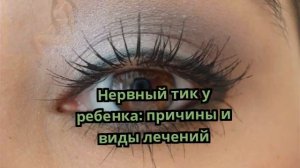 Нервный тик у ребенка: причины и виды лечений