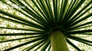 БОРЩЕВИК - РАСТЕНИЕ УБИЙЦА. Ожоги от Борщевика и их последствия!