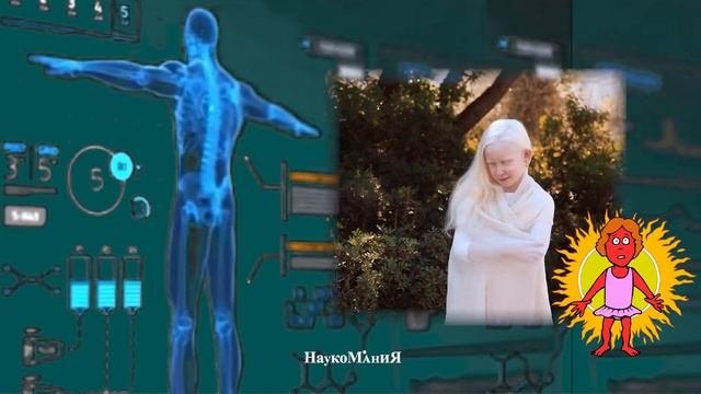 альбинос