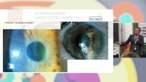 Глаз и космос: фотовидеорегистрация глаза человека | Искусство видеть 2023