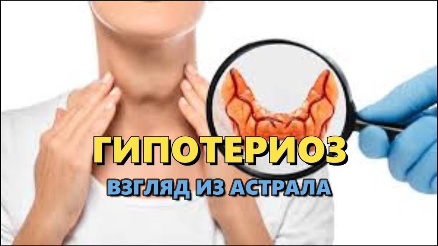 ГИПОТЕРИОЗ: ВЗГЛЯД ИЗ АСТРАЛА