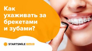 5 правил ухода за брекетами. Как чистить брекеты?