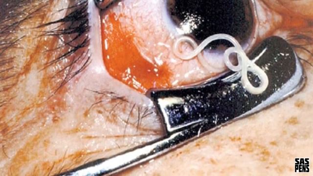 5 СУЩЕСТВ, ЖИВУЩИХ в НАШЕМ ТЕЛЕ смотреть онлайн