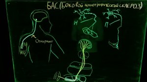 Боковой амиотрофический склероз