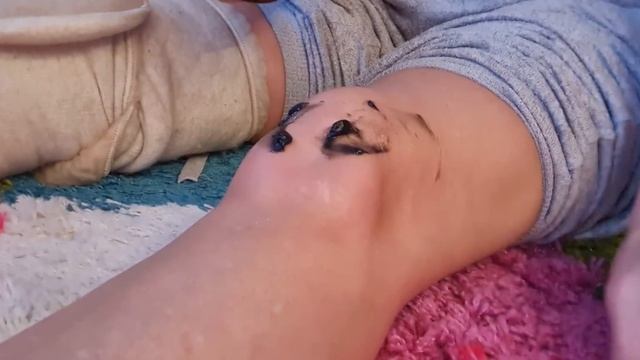 Болят колени. Что делать? Эффективный способ. Будете летать!) смотреть онлайн