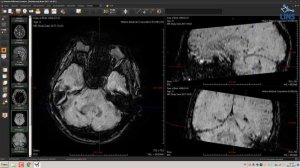 Нейрорадиология. Андрей Цориев