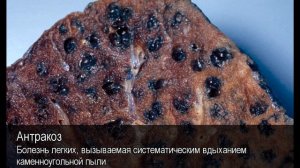 Антракоз. Толковый Видеословарь русского языка