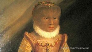 10 РЕДКИХ И СТРАШНЫХ БОЛЕЗНЕЙ ЧЕЛОВЕКА