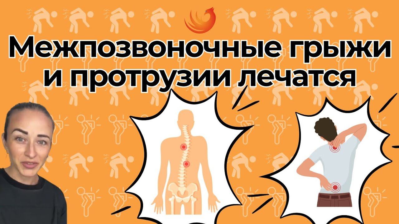 Межпозвоночные грыжи и протрузии! ❗❗❗Здоровая спина - это реальность! смотреть онлайн