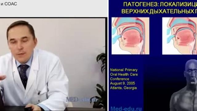 Синдром обструктивного апноэ сна. Хирургическое лечение. Р.В. Бузунов Лекция 6Синдром обструктивного смотреть онлайн