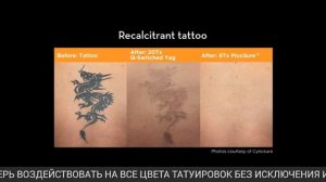 Ключевое отличие PICOSURE от других лазеров