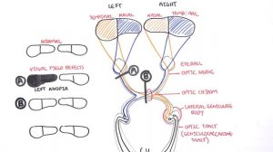 Visual Pathway and Lesions