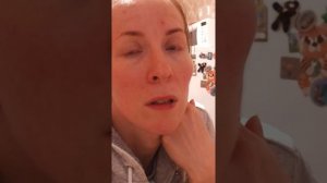 Рак молочной железы КАРЦЕНОМА внутрипротоковая инвазивная 1 а стадия.