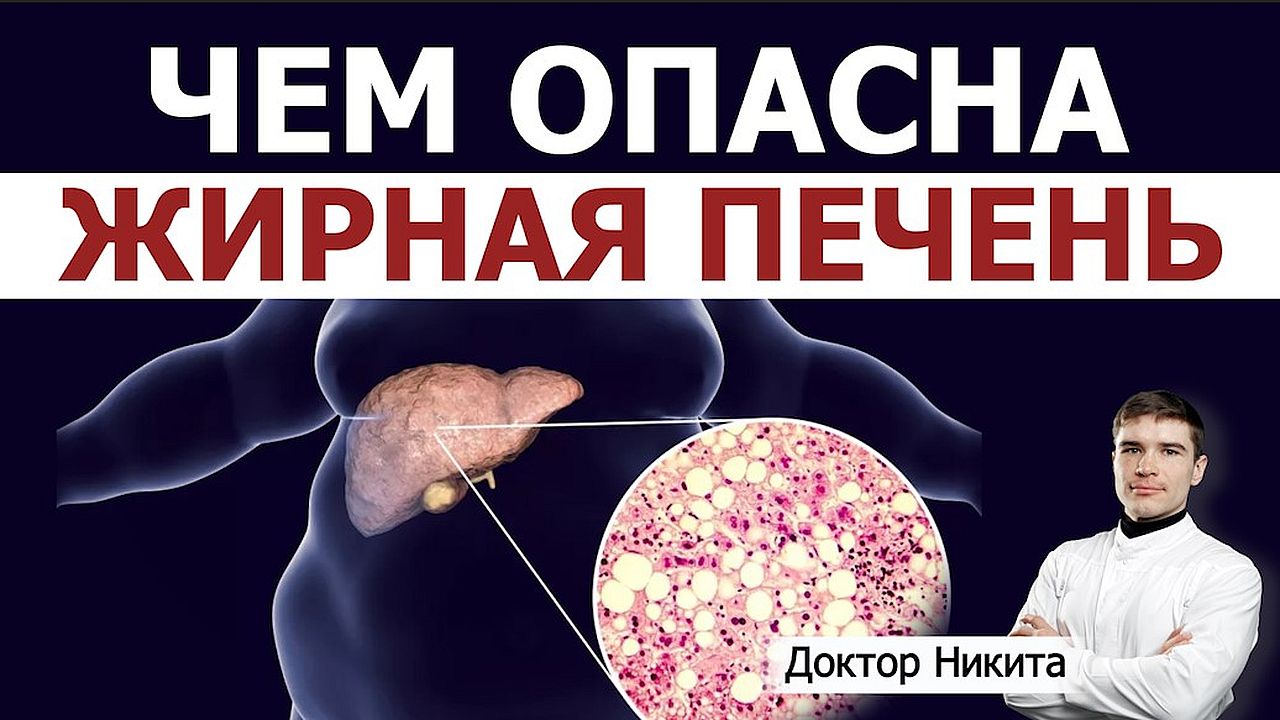 В чём коварство жирового гепатоза? Жирная печень стадии: стеатогепатит, фиброз, цирроз, рак печени