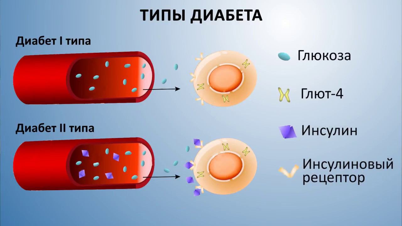 Диабет лечение травами. Сбор №17 Травы Кавказа. Энциклопедия фитотерапии