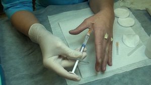 делаю себе радиесс канюлей  кисть