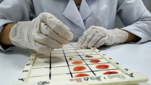 Сross blood group/ГРУППА КРОВИ. КАК ОПРЕДЕЛИТЬ ПЕРЕКРЁСТНЫМ МЕТОДОМ