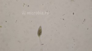 Dancing ciliate/ Танцующая инфузория под микроскопом