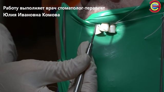 Реставрация передних резцов в стоматологии Эстетикс