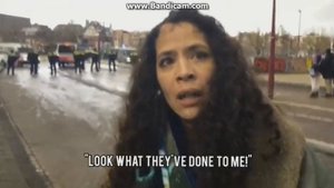 тётка с шишкой на лбу