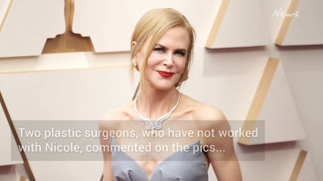 Fans accuse Nicole Kidman of changing face- 'You don't look like you' смотреть онлайн