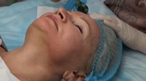 Микронидлинг - мезотерапевтическая система