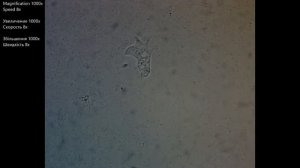 Амёба охотится (Amoeba is hunting)