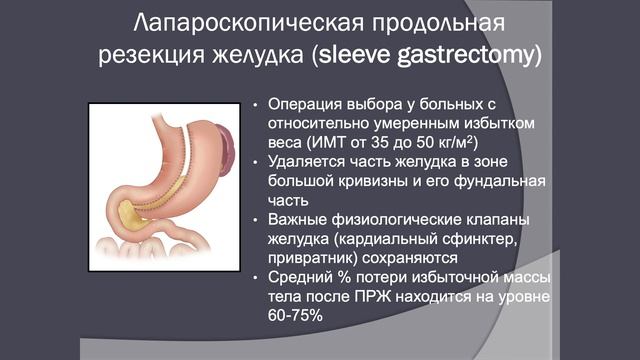 Бариатрическая хирургия