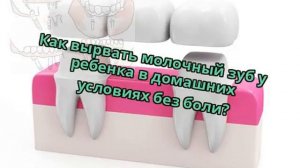 Как вырвать молочный зуб у ребенка в домашних условиях без боли?