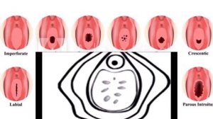 КИЗЛИК ПАРДА УЗИДАН УЗИ ЙИРТИЛАДИМИ?