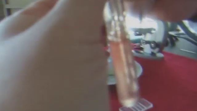 Прак. навык по физиологии: Кол-во эритроцитов смотреть онлайн