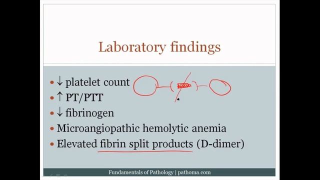 Pathoma USMLE - IV ГЛАВА - 3.Иные нарушения гемостаза