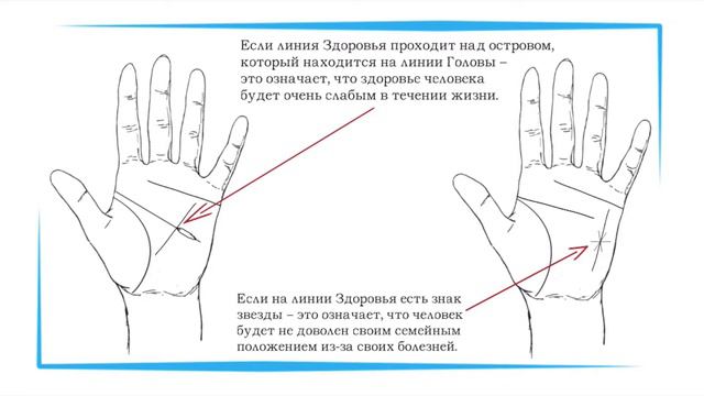 Знаки слабого здоровья на Вашей ладони. ХИРОМАНТИЯ смотреть онлайн