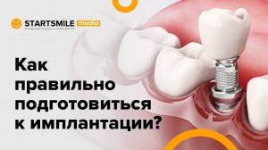 Имплантация зубов | Подготовка и первая консультация