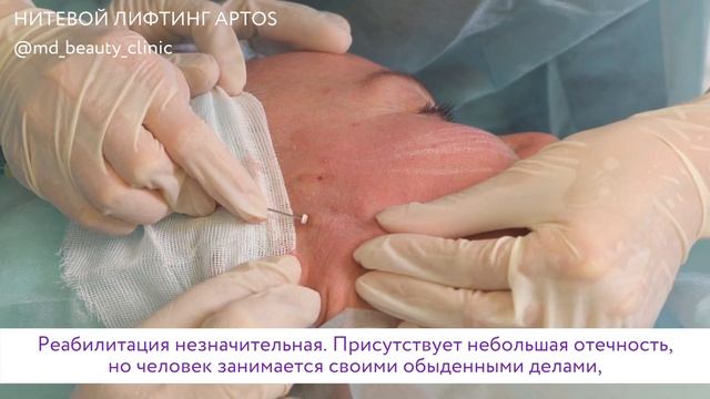 нити APTOS